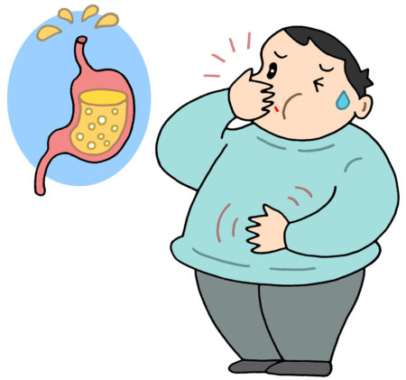 逆流性食道炎, 胸やけ,吐き気,嘔吐感,ムカムカ,逆流性胃炎,胃酸逆流