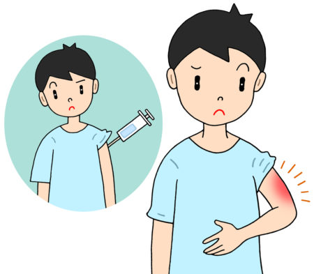 ワクチン後遺症,ワクチン接種,予防接種,副反応,副作用,腕の腫れ,痒み,発赤